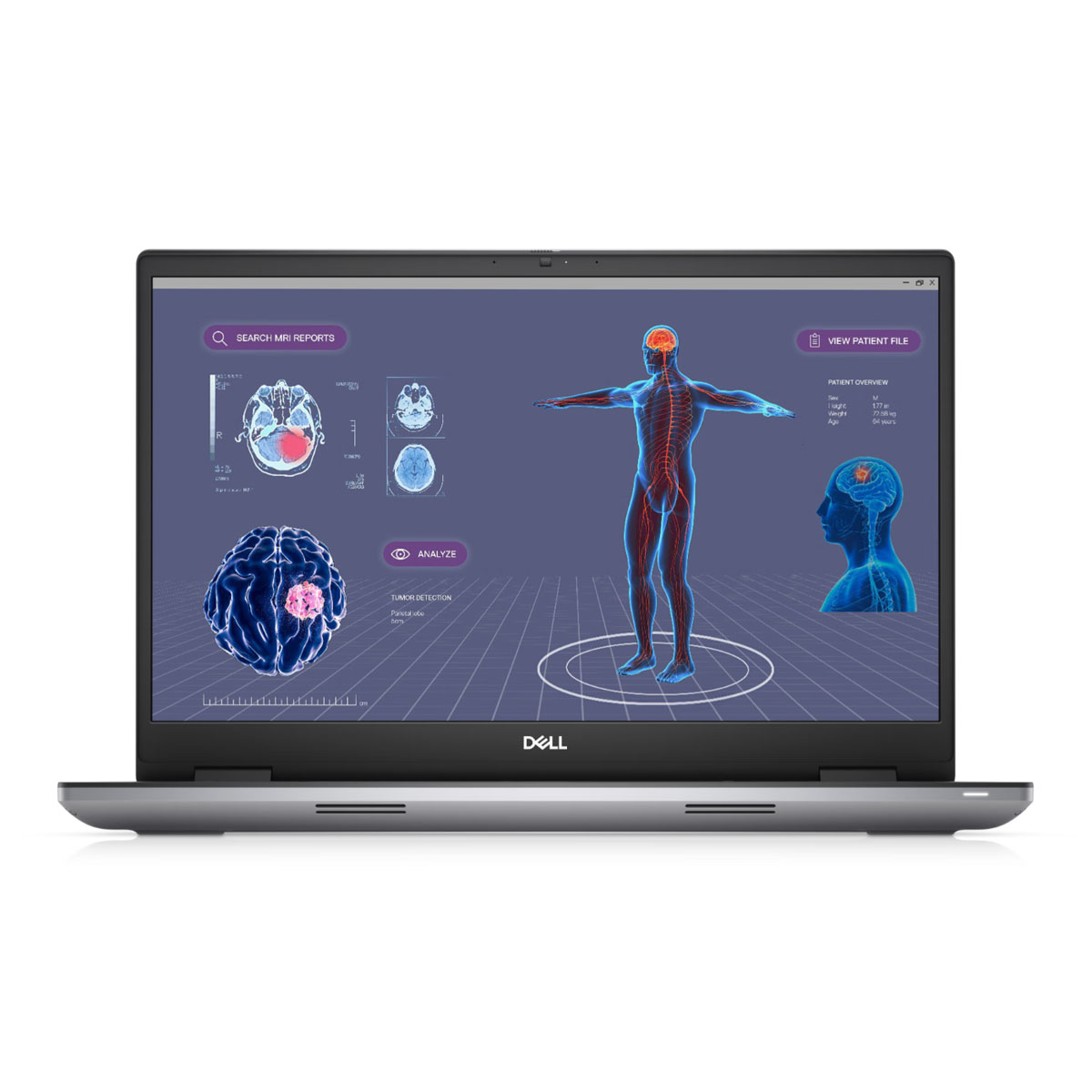 Gebraucht: Dell Precision 7780 M6HGP 17,3" FHD, Intel Core i9-13950HX, 32GB RAM, 1TB SSD, RTX3500 Windows 11 Pro | B-Ware